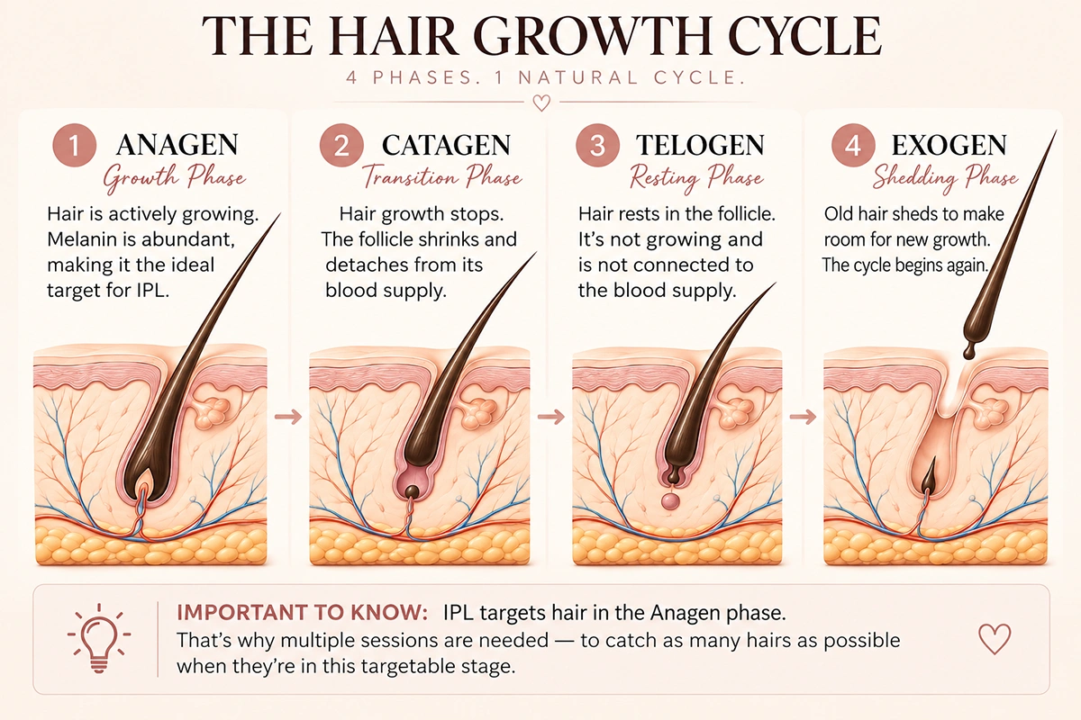 Diagram of the four phases of hair growth: anagen, catagen, telogen, and exogen