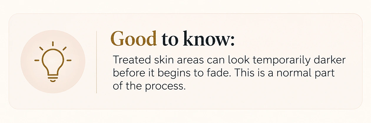 Good to know: temporary darkening of treated pigmentation can be part of the IPL process before it fades.
